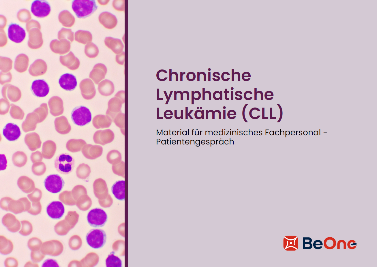 Für Ihre Patienten: Chronische Lymphatische Leukämie (CLL)