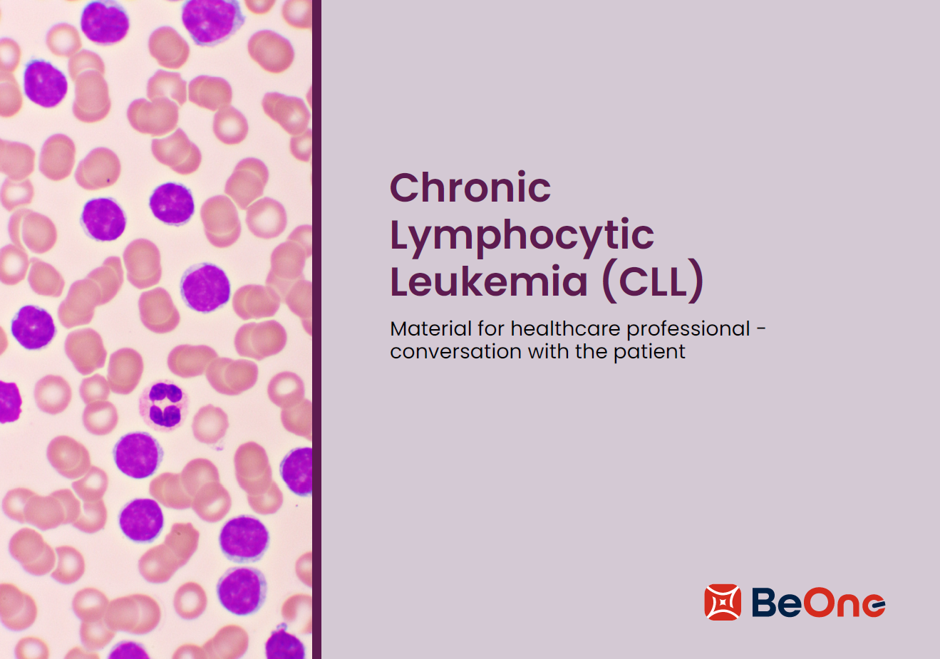 For your patients: Chronic Lymphocytic Leukemia (CLL)