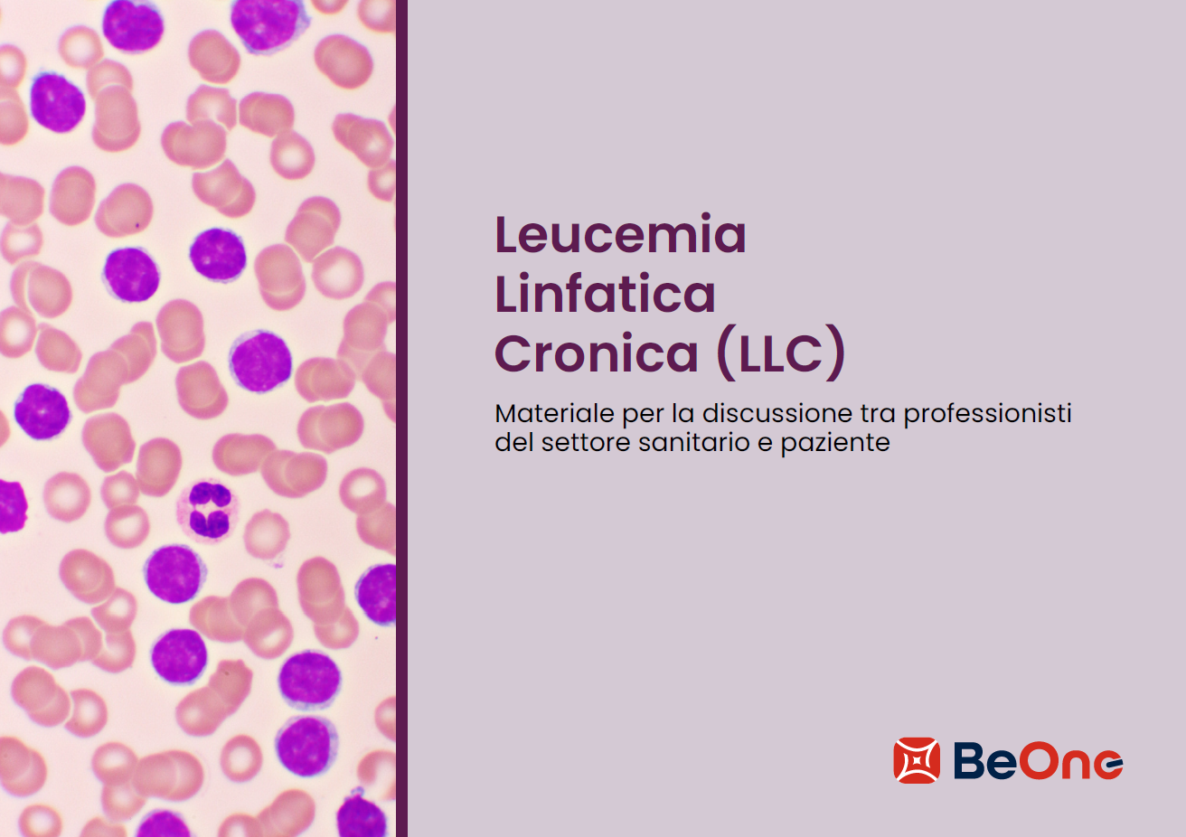 Per i suoi pazienti: Leucemia Linfatica Cronica (LLC)