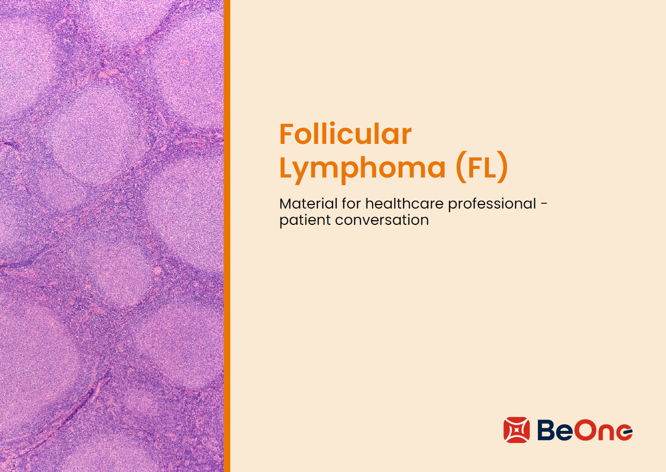 For your patients: Follicular Lymphoma (FL)