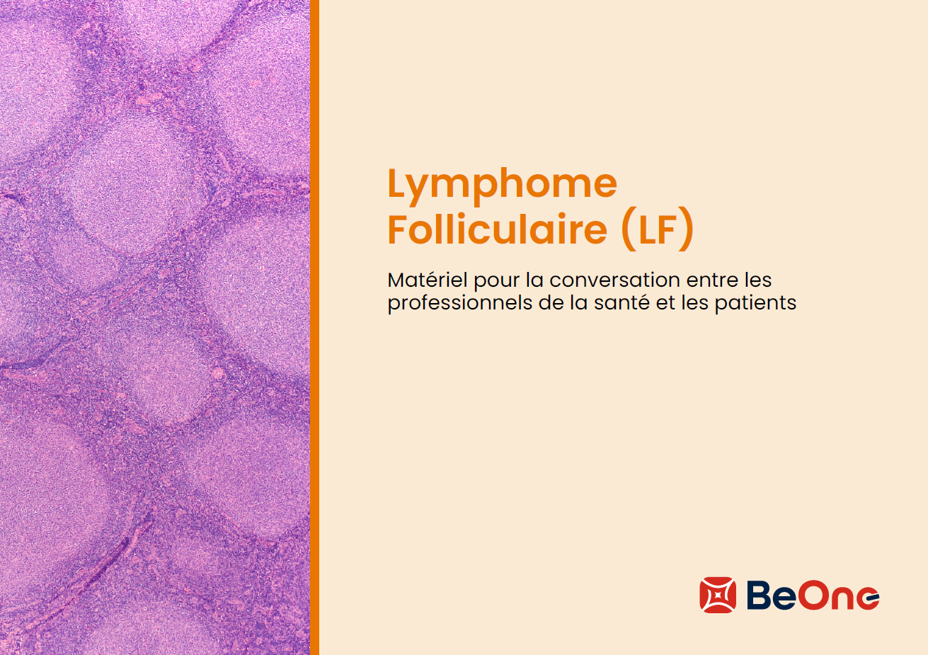 Pour vos patients: Lymphome Folliculaire (LF)