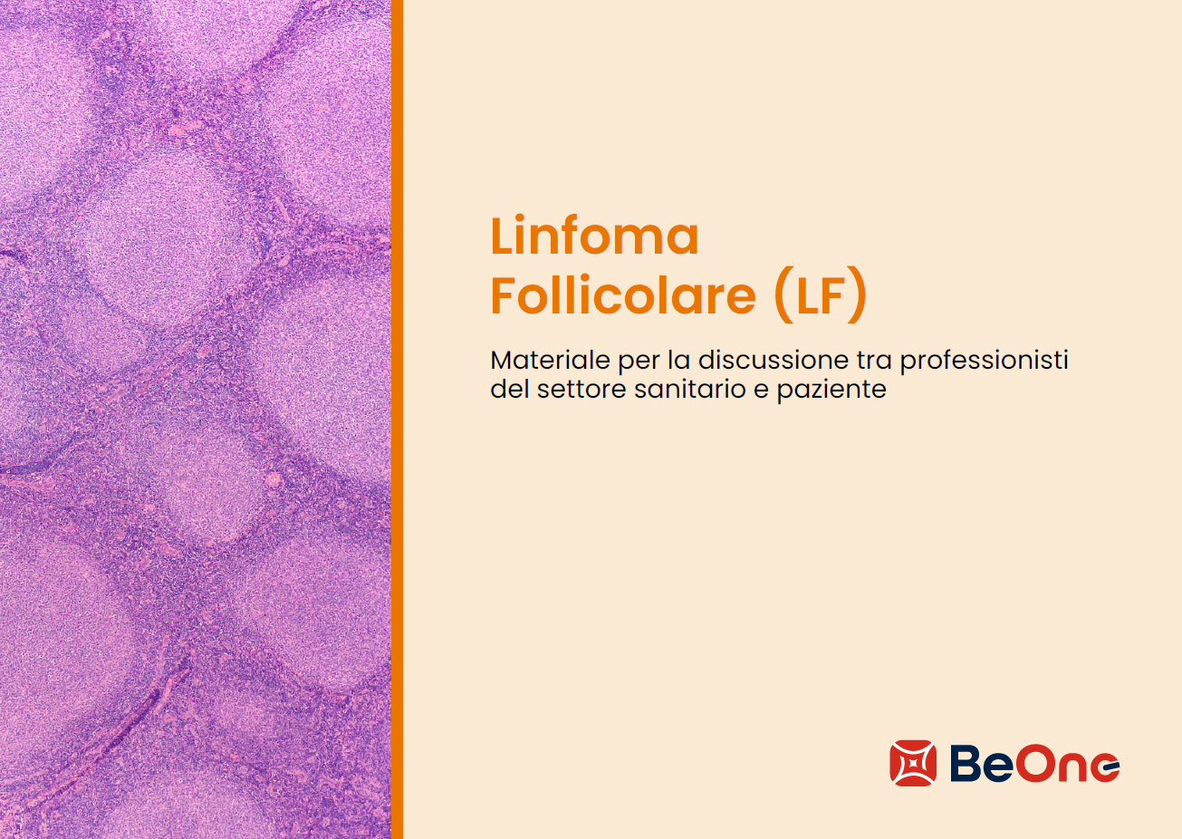 Per i suoi pazienti: Linfoma Follicolare (LF)