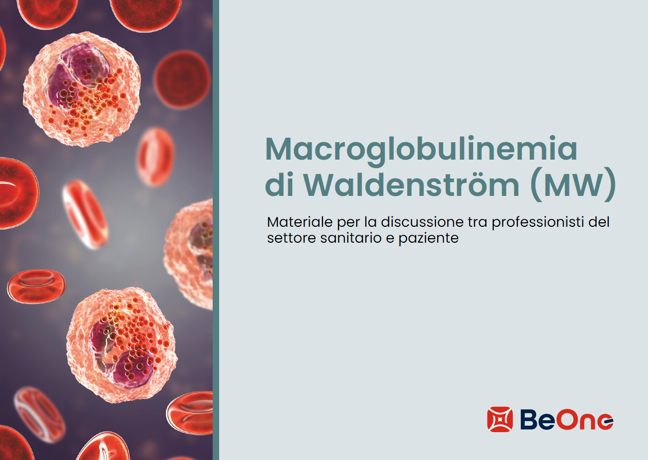 Per i suoi pazienti: Macroglobulinemia di Waldenström (MW)
